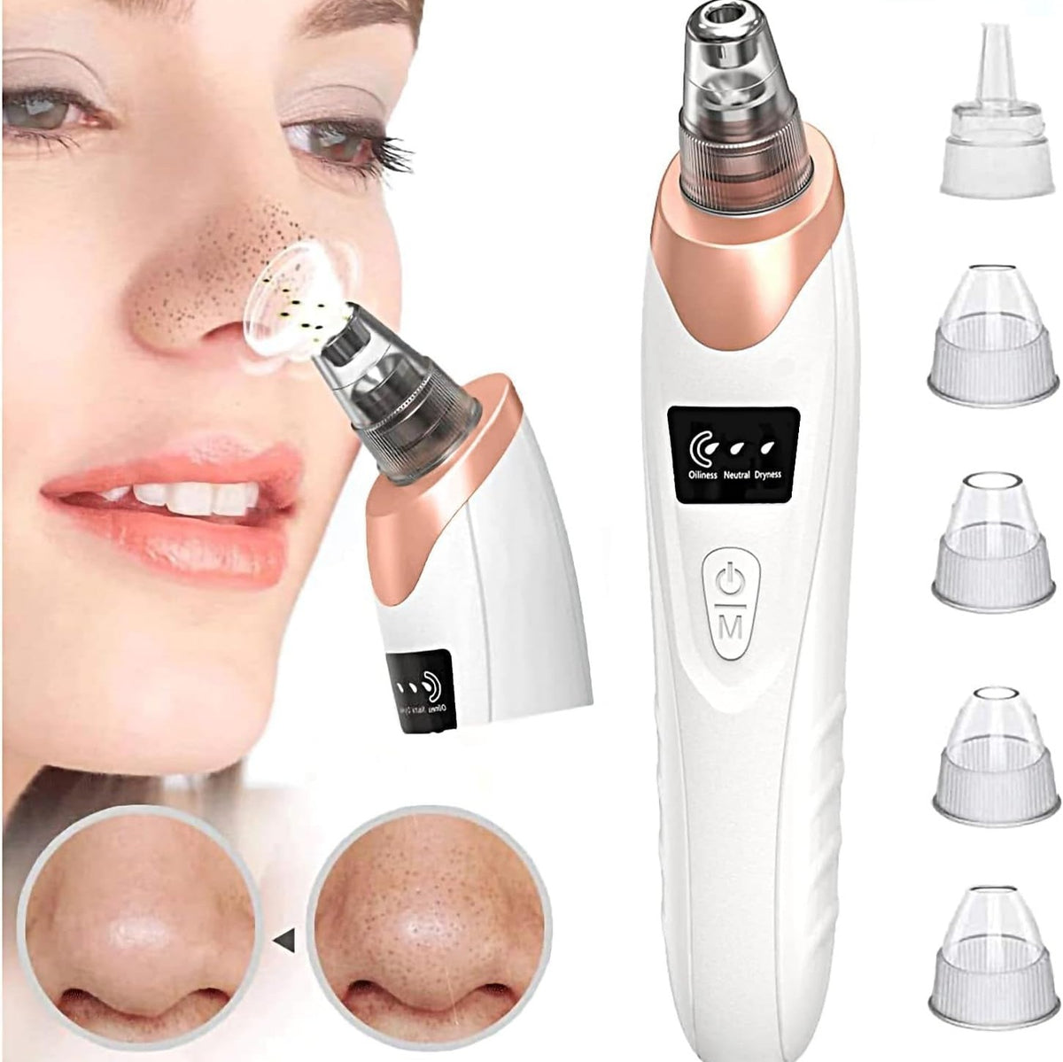5-in-1 Rechargeable Blackhead & Pore Cleaner – Facial Pore Vacuum & Removal Kit